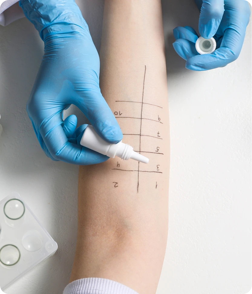 What to Expect During Your Appointment Insect Sting Allergies Treatment in San Mateo, California Banner